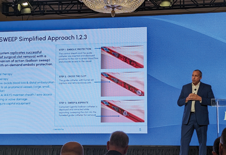 iCHOR Vascular: Innovating Simplified Thrombectomy Solutions iCHOR Vascular: Innovating Simplified Thrombectomy Solutions