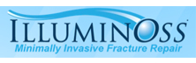  IlluminOss Medical 