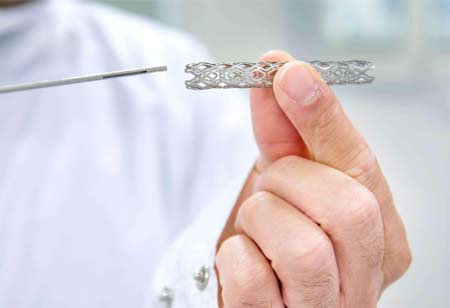 Minimally Invasive Solutions: The Future of Brain Aneurysm Treatments